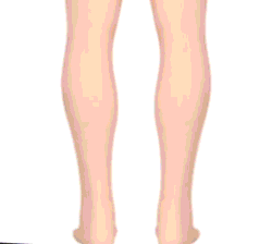 Scarpe ortopediche alla moda per donne